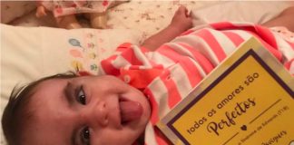 Bebê com Síndrome de Edwards está deitado com um livro próximo e olha sorridente para a câmera.