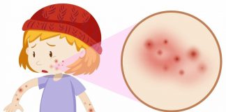 Dermatite atópica, uma manifestação alérgica, atinge 25% das crianças