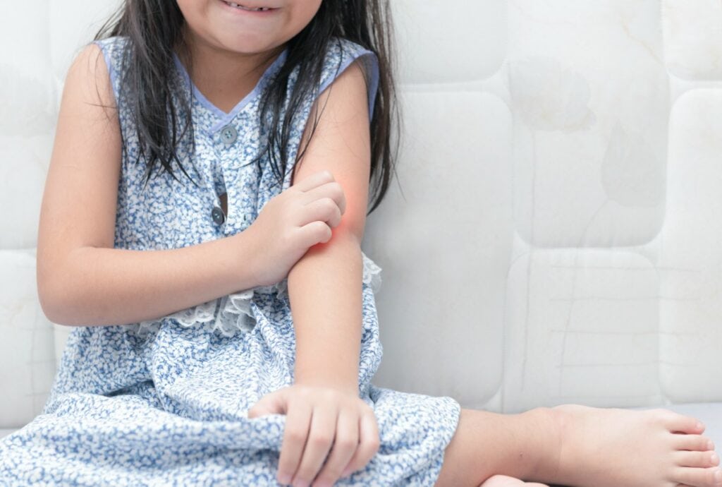 Psoríase em crianças: entenda a doença e as formas de tratamento; imagem mostra menina sentada no chão coçando cotovelo