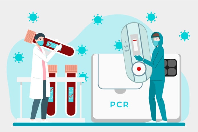 Teste de Covid Cientistas carregando teste de covid de sangue, pcr e teste rápido