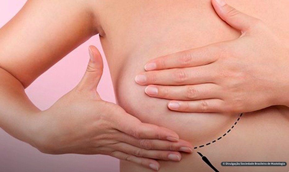 OMS: câncer de mama supera o de pulmão e é o mais comum no mundo; mulher apalpa seio com as mãos