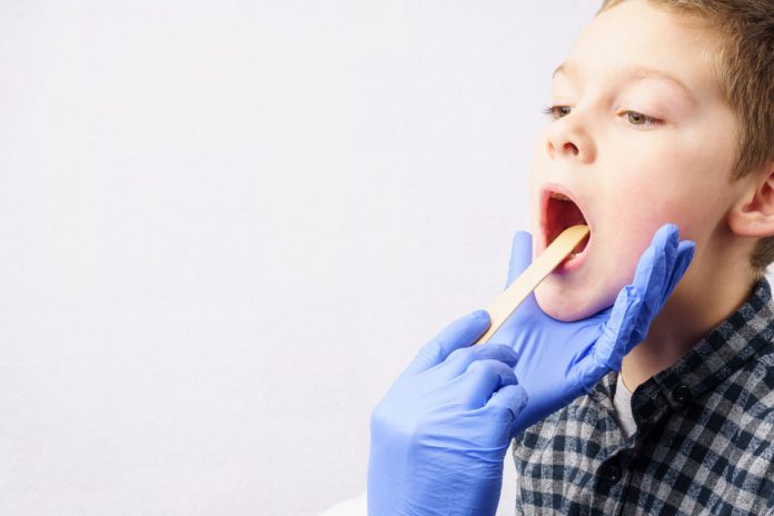 Amígdalas inflamadas - quando é indicado retirá-las; menino tem boca aberta e palito de madeira dentro para exame das amígdalas