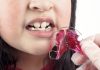 6 dúvidas comuns sobre o uso de aparelhos ortodônticos em crianças; imagem mostra boca de menina e aparelho móvel rosa em acrílico