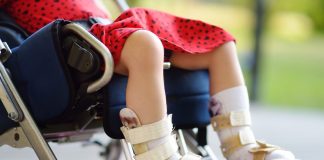 Menina em cadeira de rodas, com as pernas imobilizadas