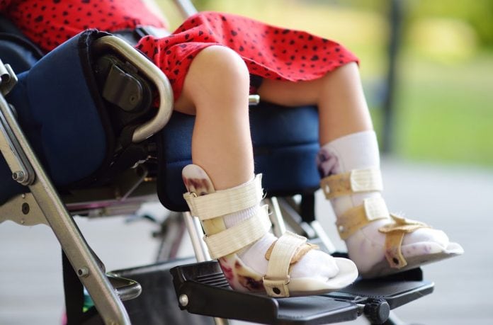 Menina em cadeira de rodas, com as pernas imobilizadas