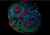 Imagem de microscopia mostrando o aspecto de um organoide cerebral derivado de células humanas., relacionado a pesquisa sobre síndrome Pitt-Hopkins, uma forma de autismo