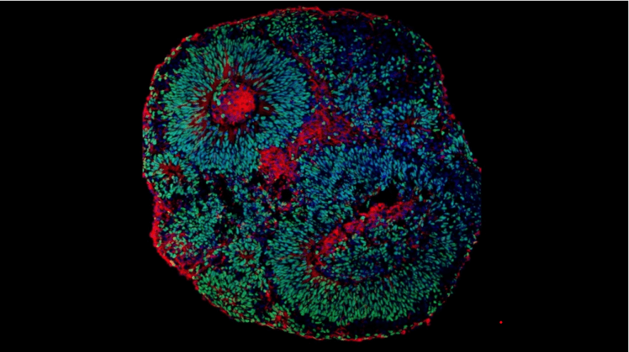 Imagem de microscopia mostrando o aspecto de um organoide cerebral derivado de células humanas., relacionado a pesquisa sobre síndrome Pitt-Hopkins, uma forma de autismo