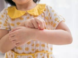 Criança com coceira no braço