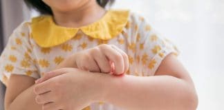 Criança com coceira no braço