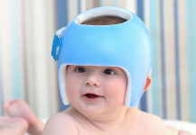 Bebê usa capacete para corrigir assimetria craniana