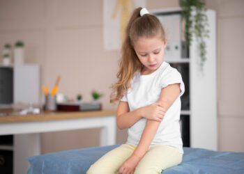 Queimaduras: É preciso saber o que fazer
Foto: Freepik